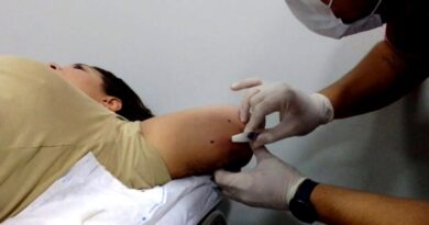 Métodos contraceptivos: saiba como acessar DIU e implante subdérmico pelo SUS em MS