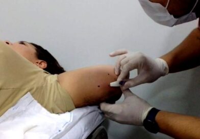 Métodos contraceptivos: saiba como acessar DIU e implante subdérmico pelo SUS em MS